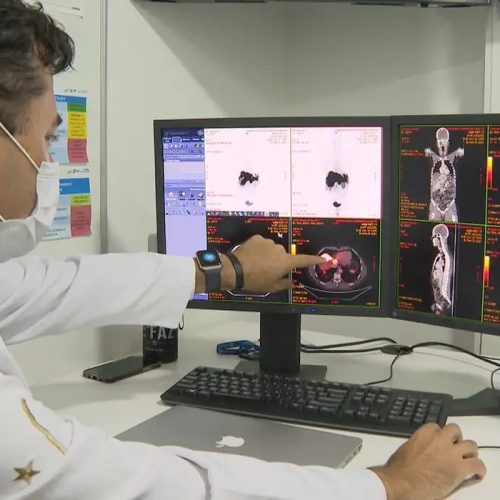 Rastreamento de câncer de intestino identifica lesões em 231 pacientes