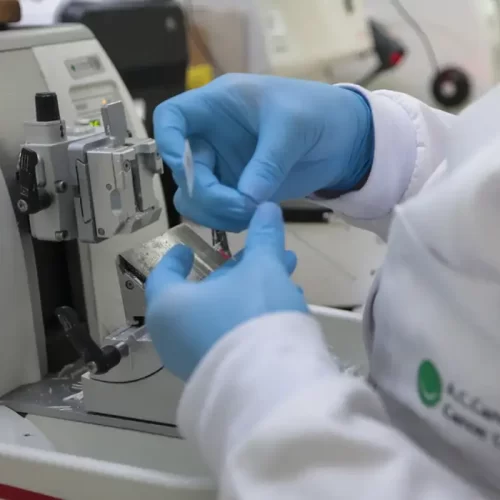 Cura de câncer de próstata pode chegar a até 98%